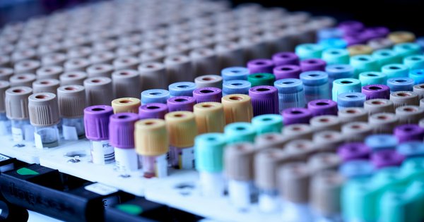 Blood sample vials and lab testing equipment