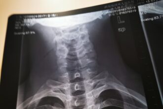 Spinal repair
